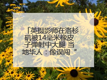 英摄影师在洛杉矶被14毫米橡皮子弹射中大腿 当地华人：像误闯“末日生存”游戏
